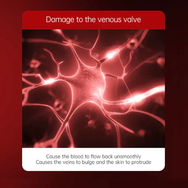Varicose Veins Relief Cream - Image 5
