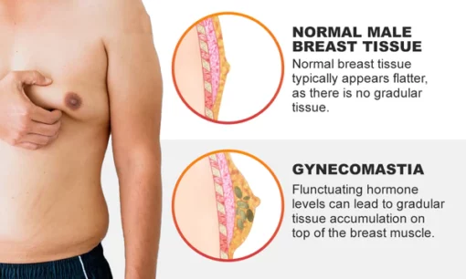 Gynecomastia Cream – Chest Fat Burner - Image 3