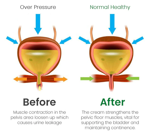 Bladder Control Cream - Image 5