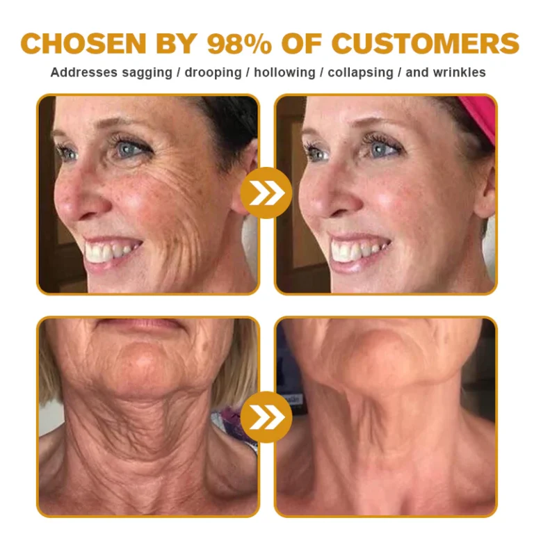 Botox Bee Venom Wrinkle Removal Cream - Image 4