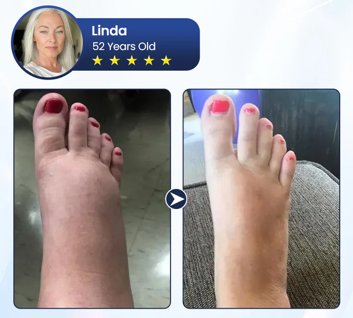 SwellRelief Circulation Support Cream