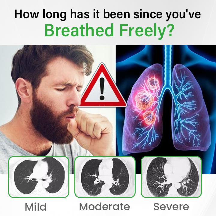 SpireFresh Quercetin Lung Detox Inhaler - Image 8