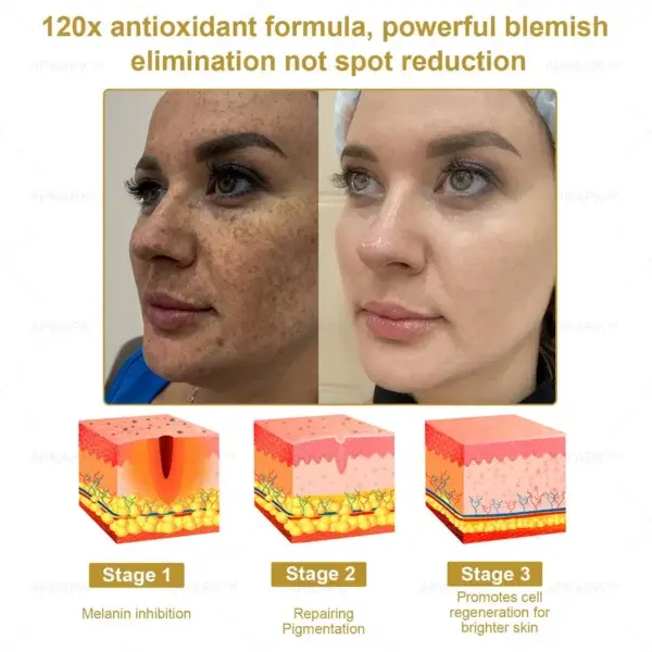 Effective All-in-One Skin Treatment Cream - Image 3