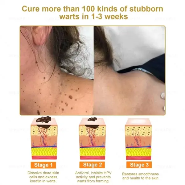 Effective All-in-One Skin Treatment Cream - Image 5