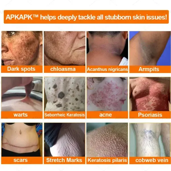 Effective All-in-One Skin Treatment Cream - Image 7