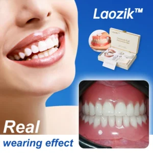 Alternative view of (Affordable --Advanced Customized Full Denture Set🦷
