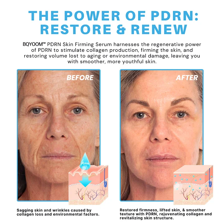 PDRN Skin Firming Serum - Image 6