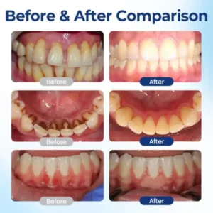 BeeTakt Oral Repair Solution - Image 5
