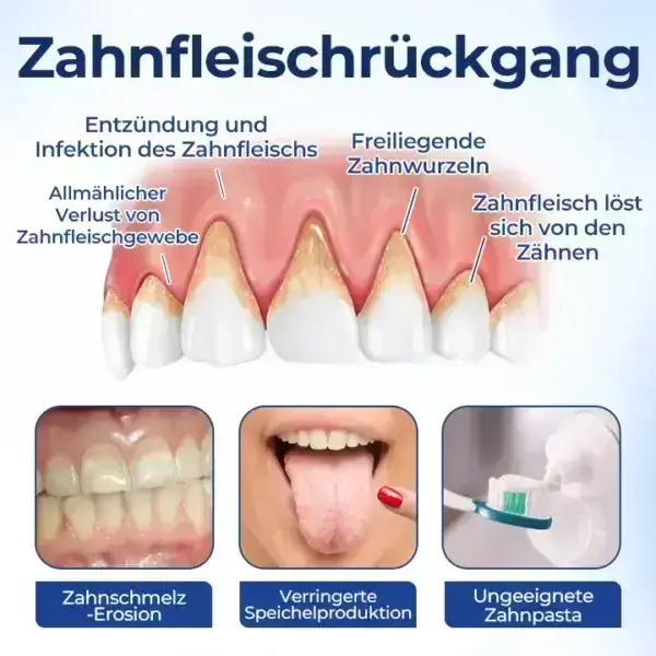 BeeTakt Zahnfleisch-Repair Lösung - Image 9