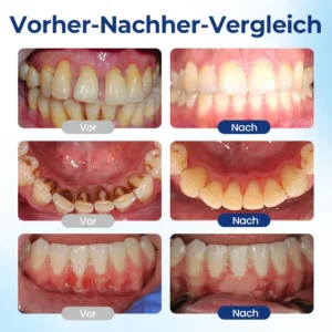 BeeTakt Zahnfleisch-Repair Lösung - Image 3