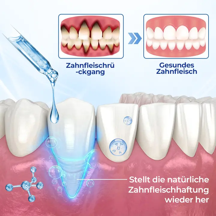 BeeTakt Zahnfleisch-Repair Lösung - Image 8