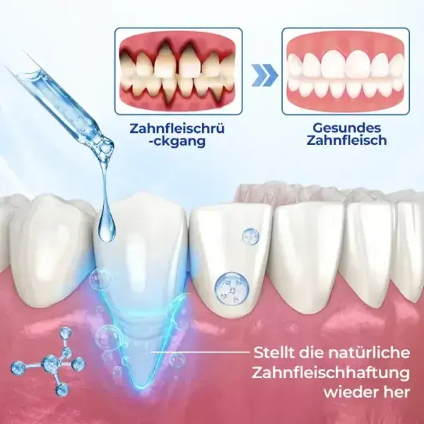 BeeTakt Zahnfleisch-Repair Lösung - Image 5