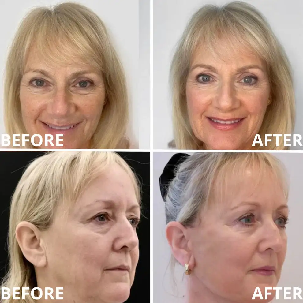 Calcium Multi Balm | Anti-Aging, Firming & Wrinkle Care - Image 5