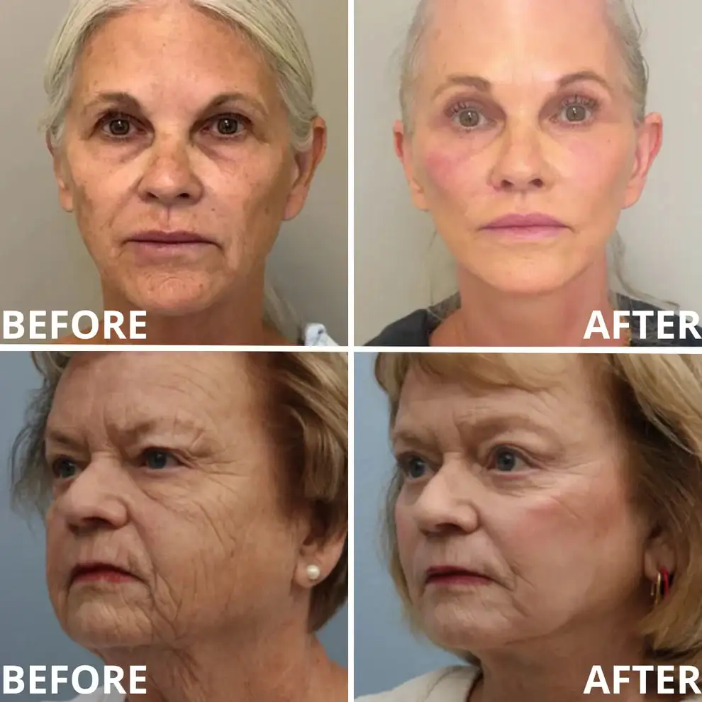 Calcium Multi Balm | Anti-Aging, Firming & Wrinkle Care - Image 6