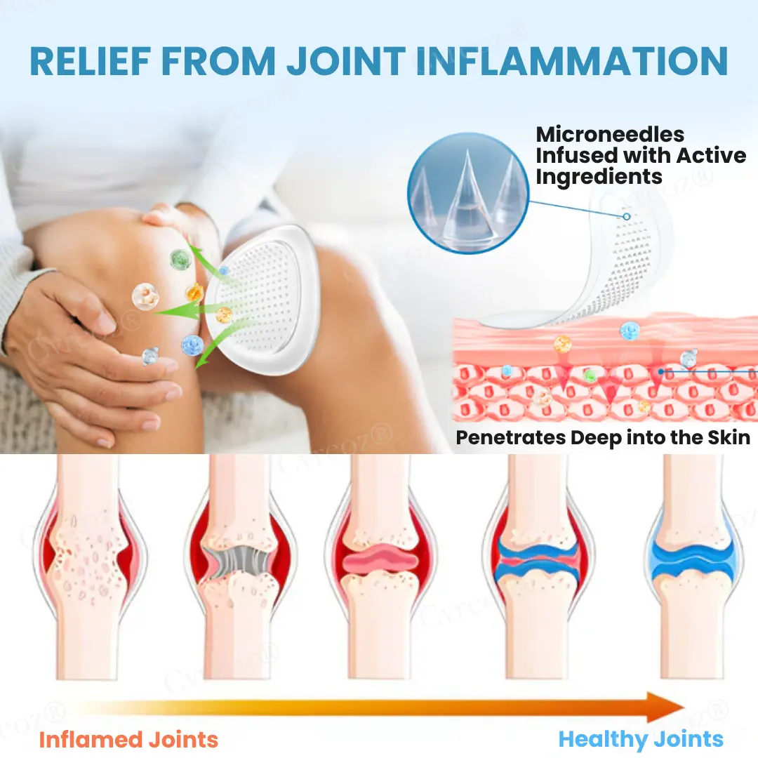 Joint Relief HA Microneedle Patch - Image 6