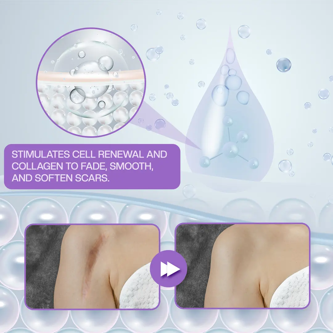 RevivaDerma Face & Body Scar Gel - Image 15