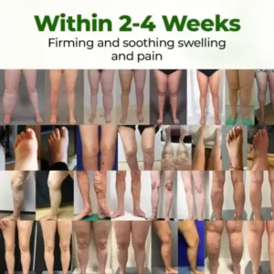 Leg Therapy Edema Cream - Image 5