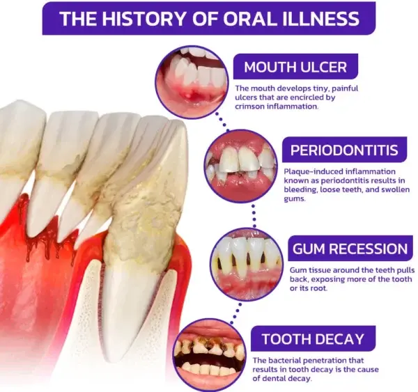 VioCore Bee Venom Dental Treatment Toothpaste - Image 9