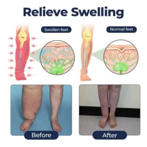 SwellRelief Circulation Support Cream - Image 6