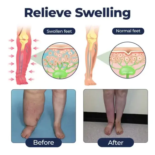 SwellRelief Circulation Support Cream - Image 6