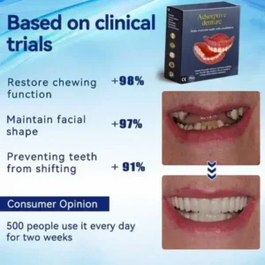 AI Bionic Adsorption Dentures - Image 6