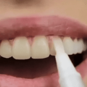Teeth Whitening Pen - Image 2
