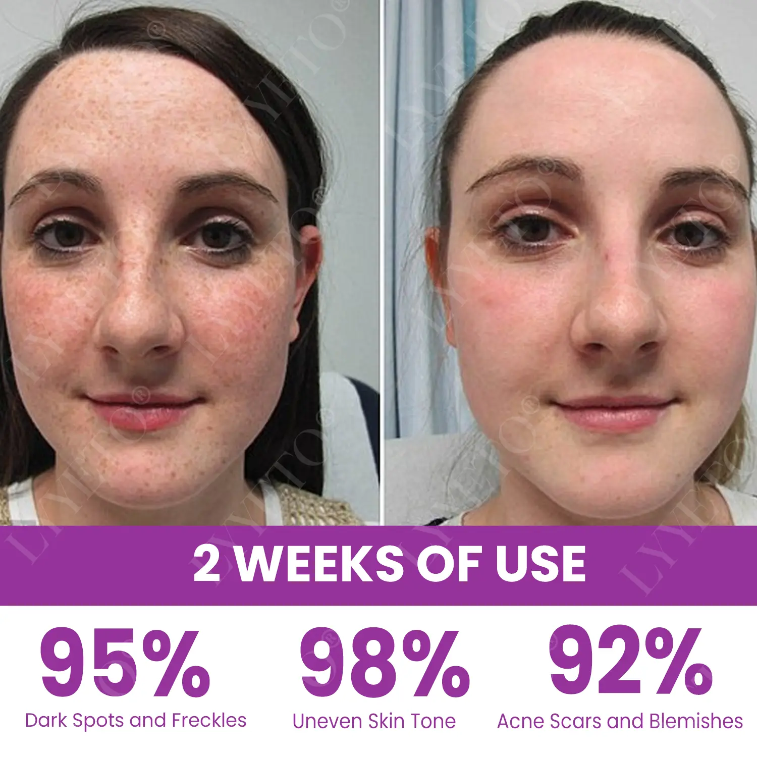 MelantraX Advanced Brightening Essence - Image 8