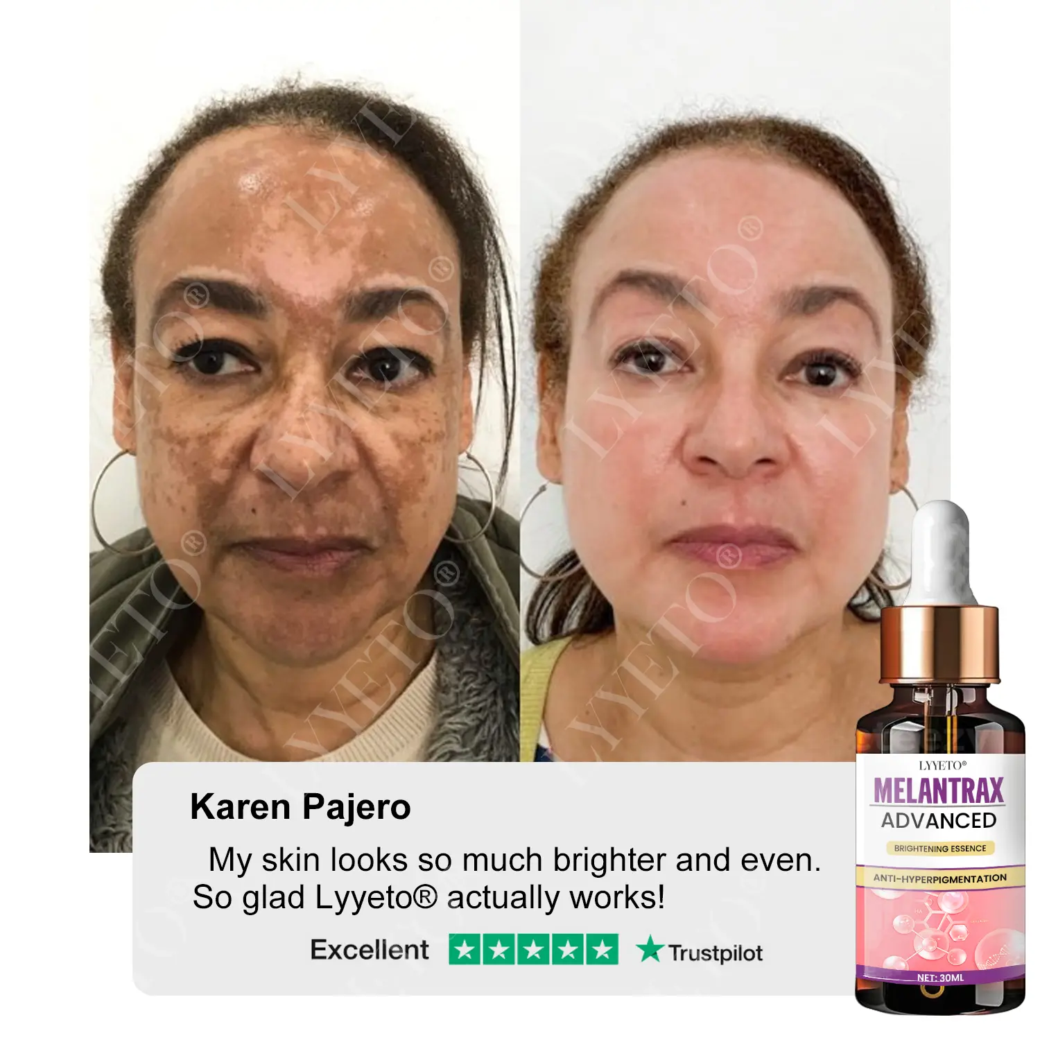 MelantraX Advanced Brightening Essence - Image 3