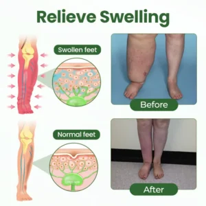 BodyRelief Circulation Cream - Image 8