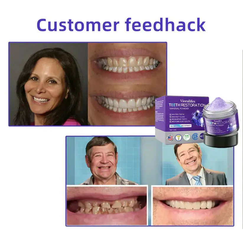 Teeth Restoration Mineral Powder - Image 7