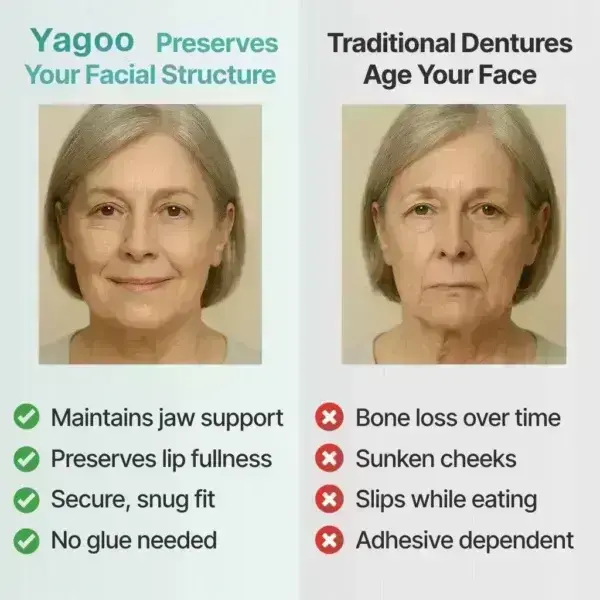 Full Denture with Strong Suction - Image 7
