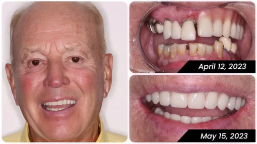 Bamboo Charcoal Whitening Toothpaste - Image 7