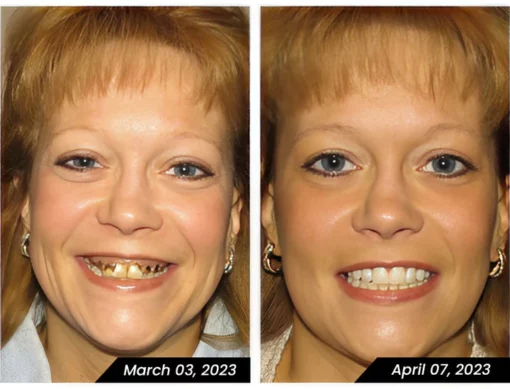 Bamboo Charcoal Whitening Toothpaste - Image 5
