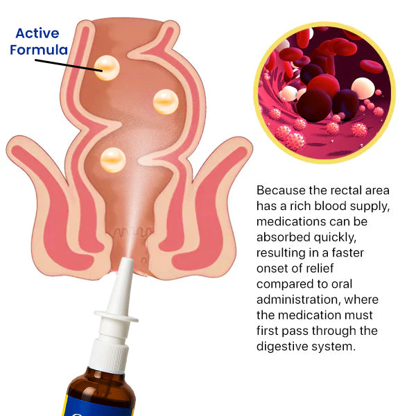 Herbal Hemorrhoid Treatment Anal Spray