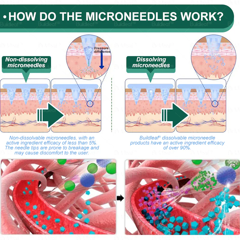 Mayo Clinic Recommended I Official Store | Nano Microneedle Patch with Collagen Peptides &Matrixyl 3000|Solution-Obesity,Cardiovascular Diseas, Diabetes, Sleep Apnea, Joint Problems and More|7-Day Results|Needle-Free Applicationwith - Image 7
