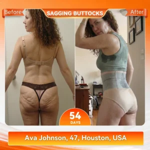 2026 NEW RELEASE Moringa & Berberine 4-In-1 Micro-Particle Sculpting & Fat-Burn Shorts - Image 4