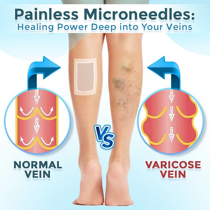 MicroNeedle Patch - Image 6