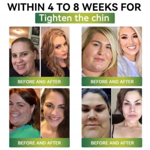 Mayo Clinic Recommended I Official Store | Nano Microneedle Patch with Collagen Peptides &Matrixyl 3000|Solution-Obesity,Cardiovascular Diseas, Diabetes, Sleep Apnea, Joint Problems and More|7-Day Results|Needle-Free Applicationwith - Image 10