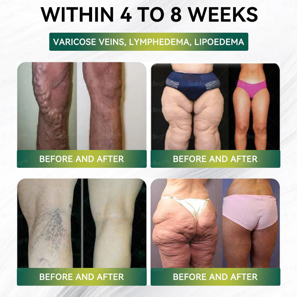 Mayo Clinic Recommended I Official Store | Nano Microneedle Patch with Collagen Peptides &Matrixyl 3000|Solution-Obesity,Cardiovascular Diseas, Diabetes, Sleep Apnea, Joint Problems and More|7-Day Results|Needle-Free Applicationwith - Image 9