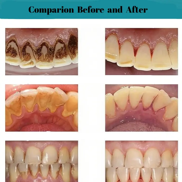 Oral Calculus Suppressant - Image 5