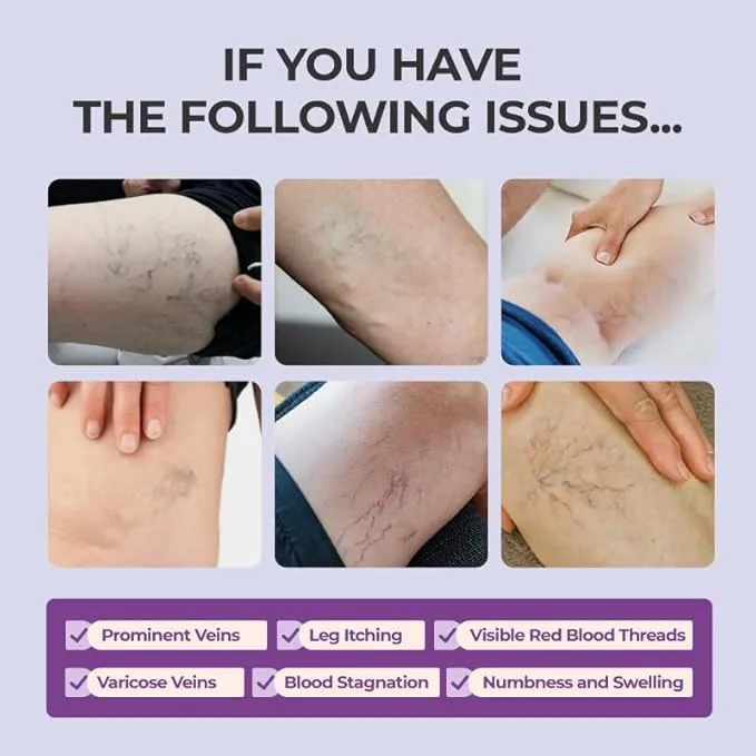 Leg Relief Varicose Veins Cream - Image 3