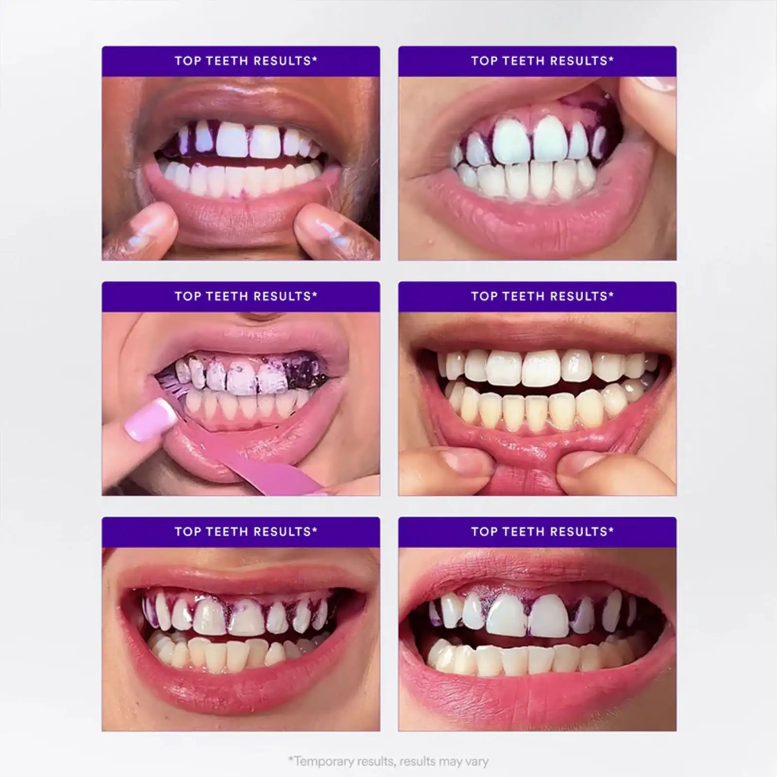 Whitening Strips - Image 7