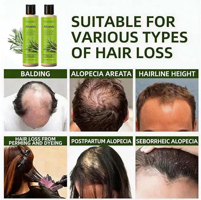Organic Rosemary Hair Growth Shampoo - Image 2