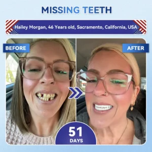 🦷 Tideglusib Fast‑Dissolving Tooth & Gum Repair Oral Strips ✨ - Image 4