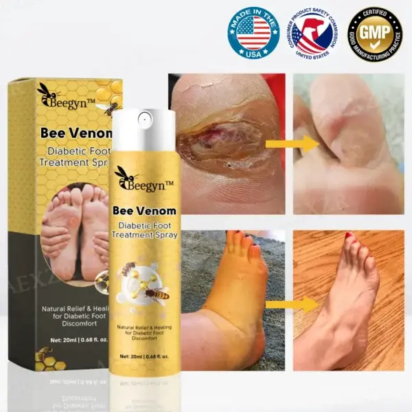 Bee Venom Diabetic Foot Treatment Spray - Image 7