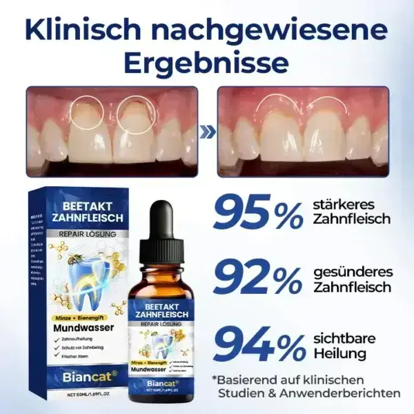 BeeTakt Zahnfleisch-Repair Lösung - Image 5