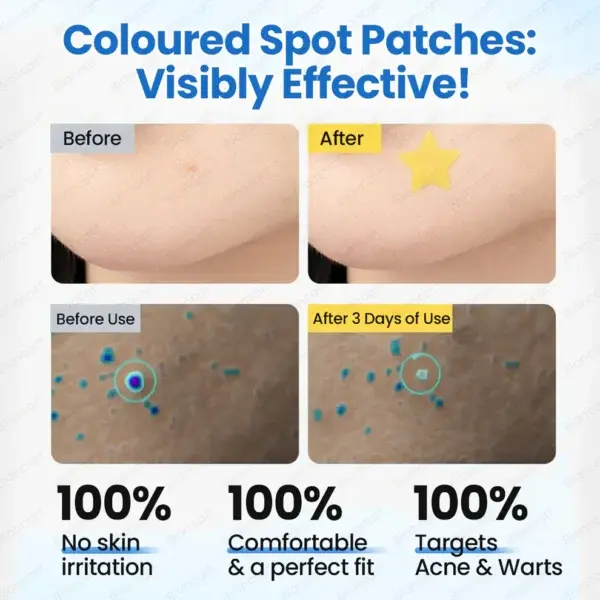 MicroHydro 2-in-1 Microneedle Patch - Image 10
