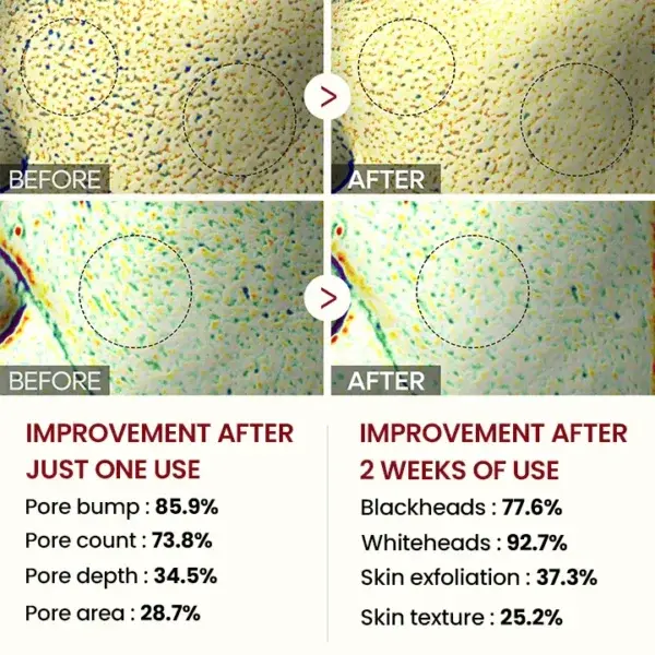 Peel Shot Glow Black Rice Ampoule - Image 7