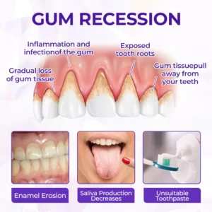 SensiGum Fluoride Toothpaste - Image 9