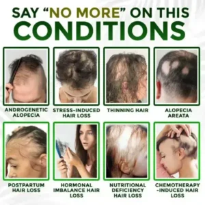👱♂️ Microneedle Herbal Infusion Hair Stimulation Set - Image 4